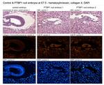 PTBP1 Antibody in Immunohistochemistry (IHC)