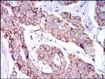 SHP2 Antibody in Immunohistochemistry (Paraffin) (IHC (P))