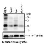 Pan Ras Antibody in Western Blot (WB)