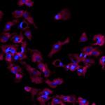 Perilipin 1 Antibody in Immunocytochemistry (ICC/IF)