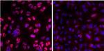 Phospho-ATM (Ser1981) Antibody in Immunocytochemistry (ICC/IF)