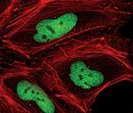 Phospho-CHK2 (Thr68) Antibody in Immunocytochemistry (ICC/IF)