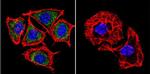 PSEN2 Antibody in Immunocytochemistry (ICC/IF)