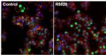 Progesterone Receptor Antibody in Immunocytochemistry (ICC/IF)