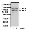 Progesterone Receptor Antibody in Western Blot (WB)