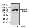 Progesterone Receptor Antibody in Western Blot (WB)