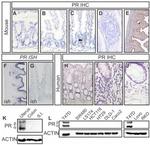 Progesterone Receptor Antibody in Western Blot, Immunohistochemistry (WB, IHC)