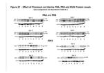 Progesterone Receptor Antibody in Western Blot (WB)