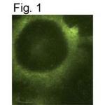 PSEN2 Antibody in Immunocytochemistry (ICC/IF)