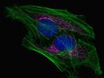 Mouse IgG (H+L) Secondary Antibody in Immunocytochemistry (ICC/IF)