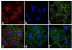 Rat IgG (H+L) Secondary Antibody in Immunocytochemistry (ICC/IF)