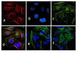 Rabbit IgG (H+L) Secondary Antibody in Immunocytochemistry (ICC/IF)