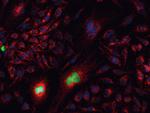 Mouse IgG (H+L) Cross-Adsorbed Secondary Antibody in Immunocytochemistry (ICC/IF)