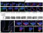 Myc Tag Antibody in Immunoprecipitation (IP)