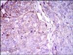 Rab4 Antibody in Immunohistochemistry (Paraffin) (IHC (P))