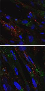 RAB5 Antibody in Immunocytochemistry (ICC/IF)