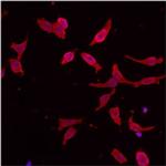 RAB5 Antibody in Immunocytochemistry (ICC/IF)