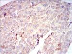 c-Raf Antibody in Immunohistochemistry (Paraffin) (IHC (P))