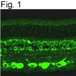 RANBP2 Antibody in Immunohistochemistry (IHC)