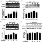 CD265 (RANK) Antibody in Western Blot (WB)