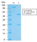 Biotin (Vitamin B7 or Vitamin H) Antibody in SDS-PAGE (SDS-PAGE)