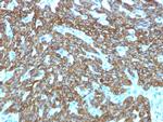 Cytokeratin, Basic (Type II or HMW) Antibody in Immunohistochemistry (Paraffin) (IHC (P))