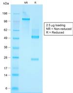 Cytokeratin, Basic (Type II or HMW) Antibody in SDS-PAGE (SDS-PAGE)