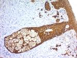 Cytokeratin, Basic (Type II or HMW) Antibody in Immunohistochemistry (Paraffin) (IHC (P))