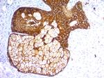 Cytokeratin, pan Antibody in Immunohistochemistry (Paraffin) (IHC (P))