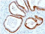 Cytokeratin, Basic (Type II or HMW) Antibody in Immunohistochemistry (Paraffin) (IHC (P))