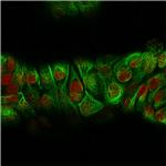 Cytokeratin, Basic (Type II or HMW) Antibody in Immunocytochemistry (ICC/IF)