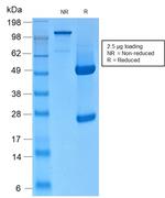 Cytokeratin, Basic (Type II or HMW) Antibody in SDS-PAGE (SDS-PAGE)