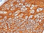 Cytokeratin, Type I (Epithelial Marker) Antibody in Immunohistochemistry (Paraffin) (IHC (P))