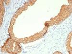 Cytokeratin, Type II (Epithelial Marker) Antibody in Immunohistochemistry (Paraffin) (IHC (P))