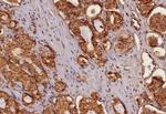 Cytokeratin, pan (Epithelial Marker) Antibody in Immunohistochemistry (Paraffin) (IHC (P))