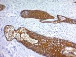 Cytokeratin, pan (Epithelial Marker) Antibody in Immunohistochemistry (Paraffin) (IHC (P))