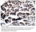 RBP2 Antibody in Immunohistochemistry (IHC)