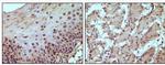 Rb Antibody in Immunohistochemistry (Paraffin) (IHC (P))