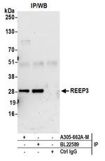 REEP3 Antibody in Immunoprecipitation (IP)