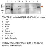 ROCK1 Antibody in Western Blot (WB)