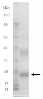 SARS-CoV-2 Spike Protein (RBD) (aa330-524), His Tag Protein