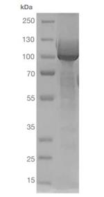 Human ACE2 (aa1-615) Fc Chimera Protein