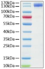 Human ACE2 (aa18-740) Fc Chimera Protein in SDS-PAGE (SDS-PAGE)