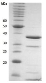 Human HTRA1 Protein