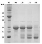 Human HTRA1 Protein