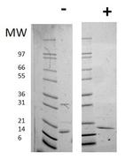 Human IL-16 Protein