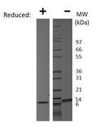 Human CXCL10 (IP-10) Protein