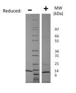 Human CCL7 (MCP-3) Protein