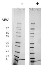 Human CCL18 (MIP-4) Protein