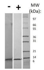 Human CCL3 (MIP-1 alpha) Protein